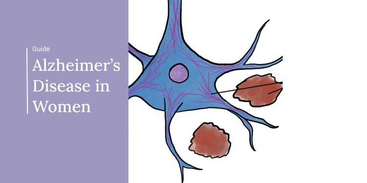 Alzheimer's Disease in Women: Questions and Resources